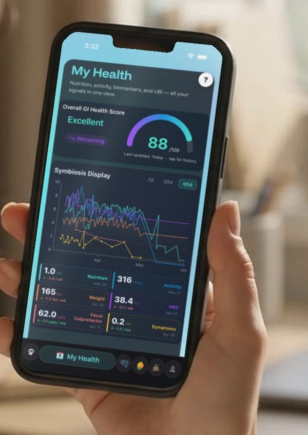 UBi's My Health screen on a phone showing the GI health score and trends